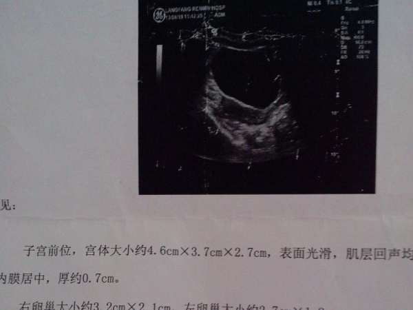 单角子宫怎样容易怀孕