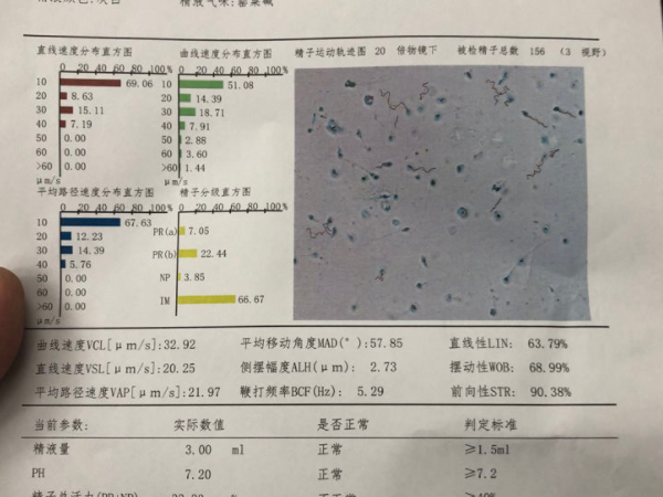 禁欲15天能不能检查精液质量