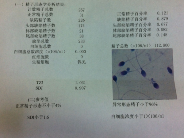 增加y精子能不能生男孩