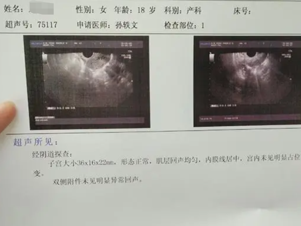 幼稚子宫能不能怀孕