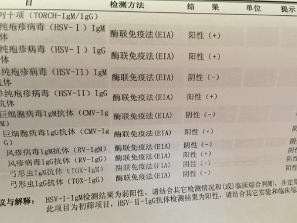 优生优育十项检查是不是必须做