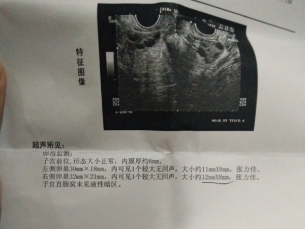 有卵泡不怀孕咋回事