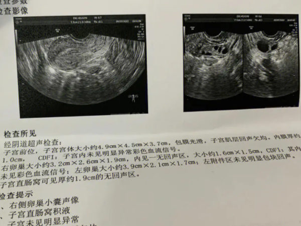 卵子质量检查方法有哪些