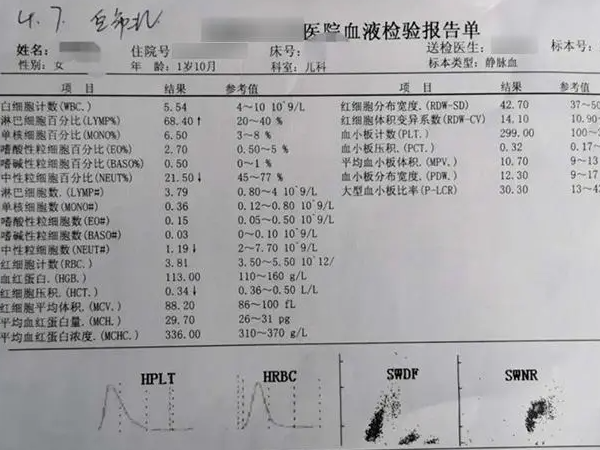 蚕豆病的症状有哪些