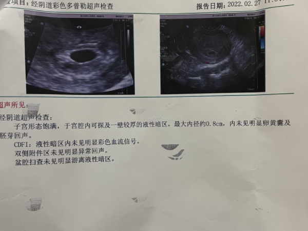 判断空孕囊的方法有哪些