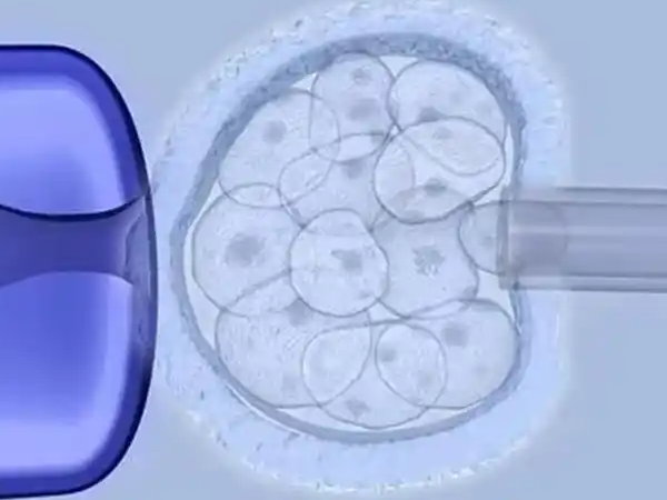 残角子宫可不可以做试管