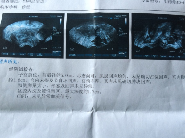 内膜a型适不适合移植胚胎