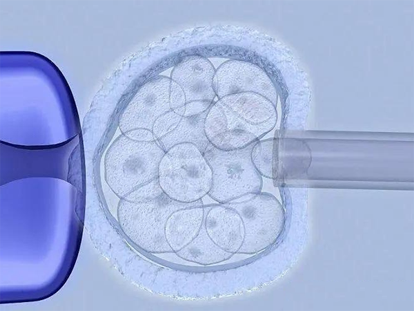 三代试管囊胚筛查要多久？