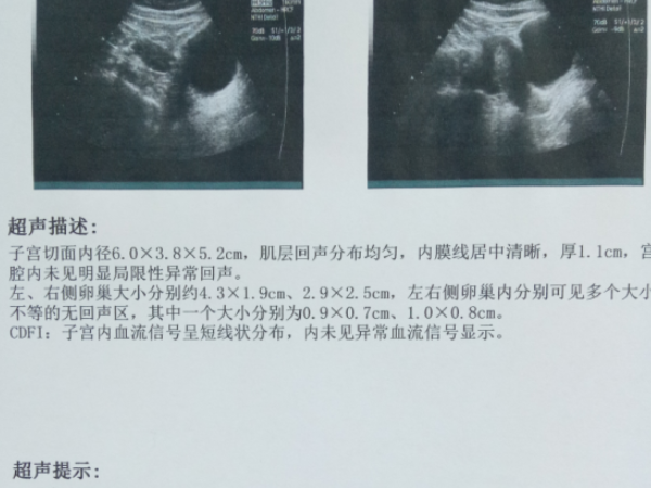 女性子宫内膜0.4cm能不能怀孕