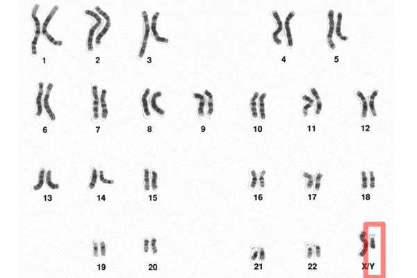 染色体sy1192缺失影响生育