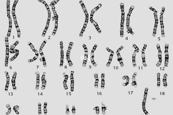 10号染色体缺失影响生育