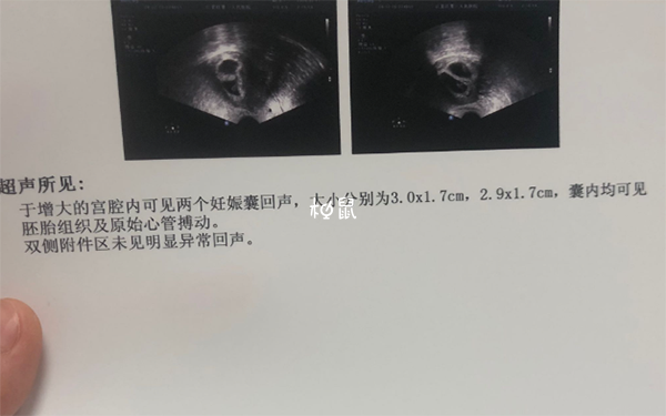 囊胚移植31天孕囊在2cm左右