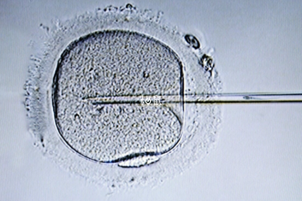6cb囊胚质量一般