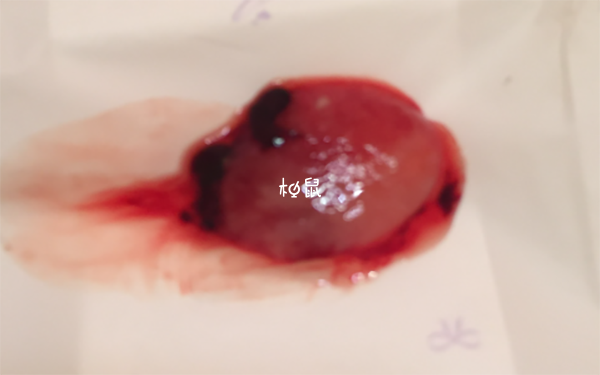 囊胚被排出会流血