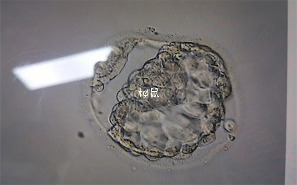 移植囊胚