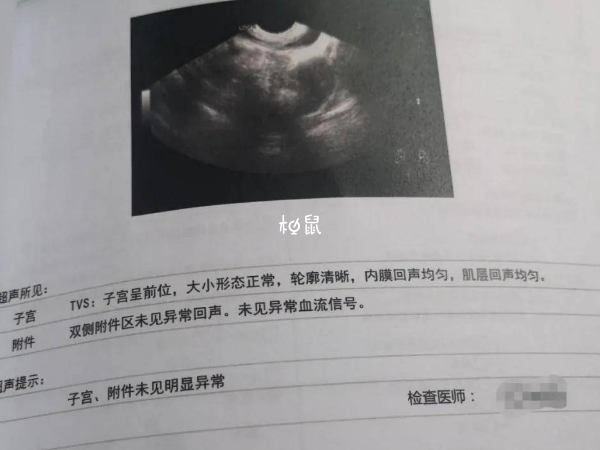 子宫B超图片可以查看子宫内膜厚度