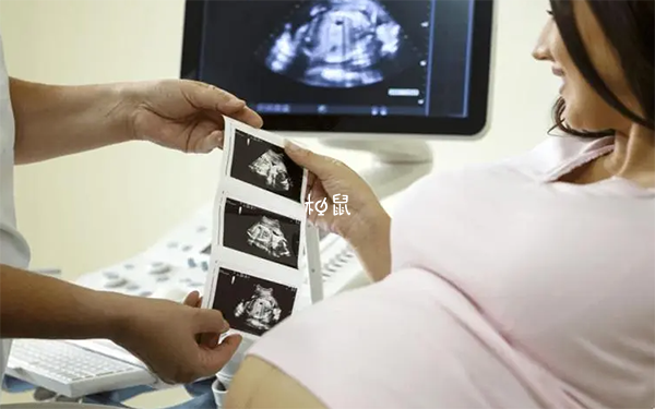 小排畸检查通常在孕晚期进行