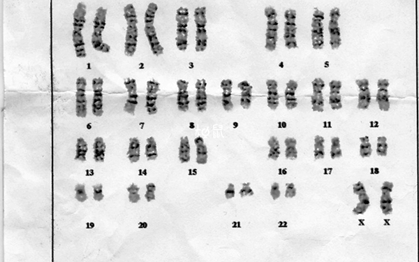 染色体检查报告单看染色体核型