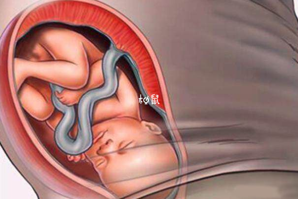 医生凭借经验能判断胎儿是否入盆