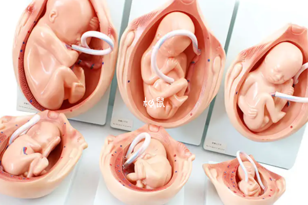 胎盘早剥严重者需要及时终止妊娠