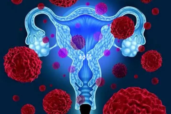 宫颈癌初期容易出现分泌物异常