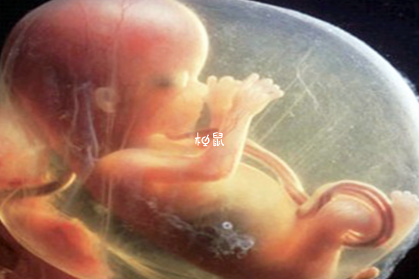 胎儿脐带绕颈4大原因是揭晓，别再信是妈妈“摸”出来的了(图1)