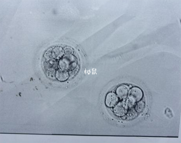 胚胎质量不好可以移植两个胚胎