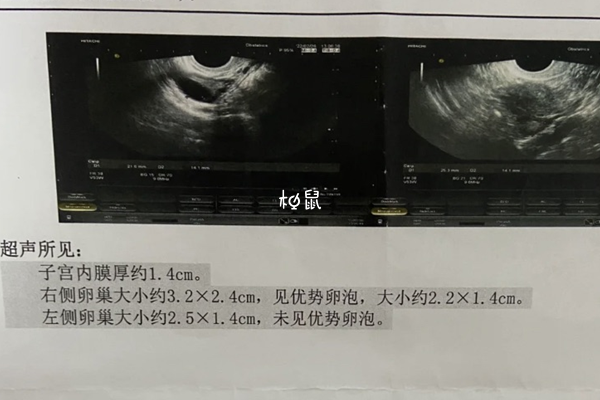 子宫内膜正常厚度是5-10mm之间