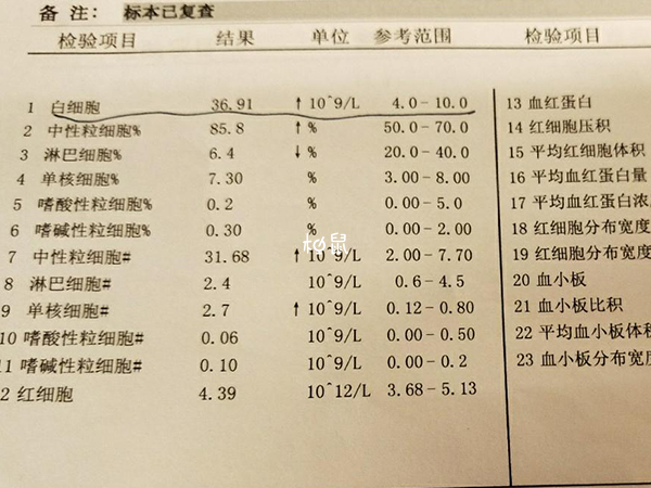 白细胞高或影响着床