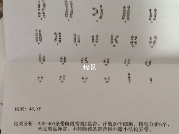 染色体数目变异是一种比较常见的类型