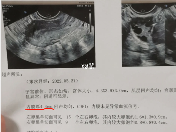 备孕子宫内膜8-10mm正常