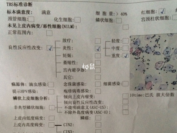 子宫抹片检查可以明确是否存在妇科病