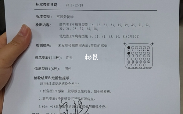 tct检查数值阴性是正常的