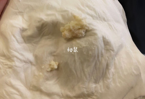 雪诺酮排出的药渣颜色比较多