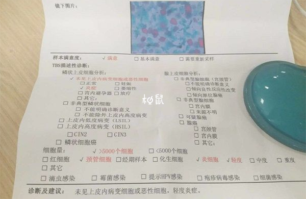 TCT检查报告单指标解读