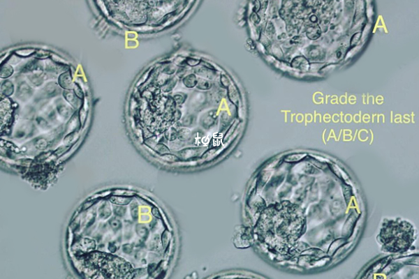 囊胚成功率比鲜胚高