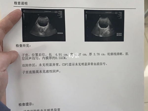 内膜较厚做试管不一定成功