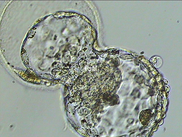 囊胚成功率最高70%