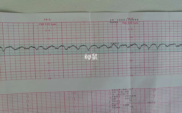 胎心监护120多是正常的