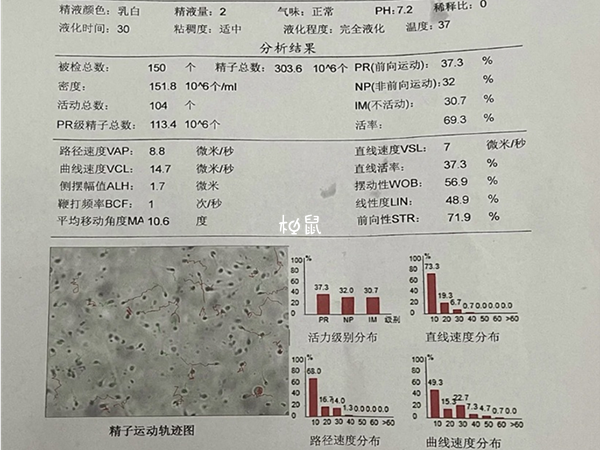 试管婴儿需要挑选精子碎片