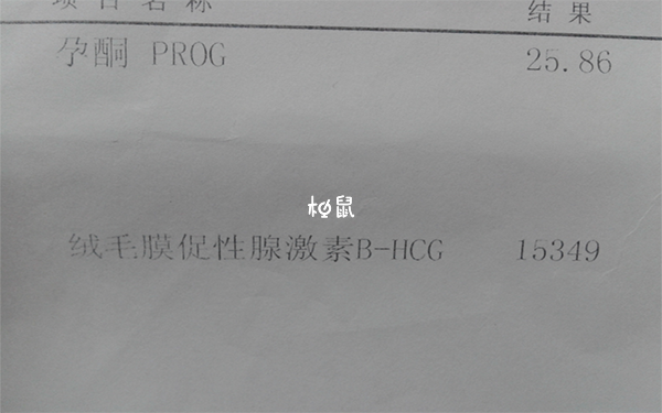 早孕抽血hcg值是5~50mlU/mL