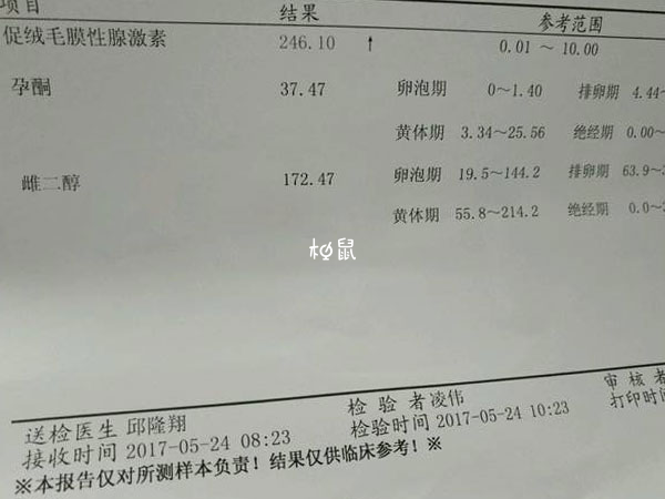 上午和下午查孕酮区别不大