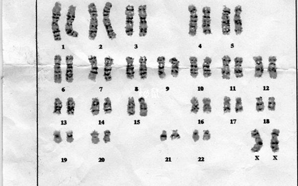 夫妻做染色体检查价格不固定