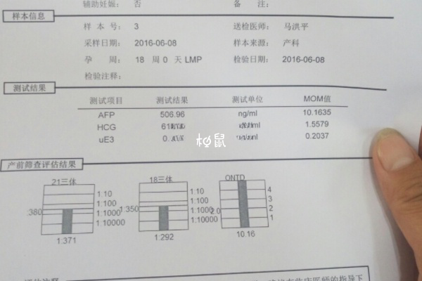 后悔做唐氏筛查是因为结果不准