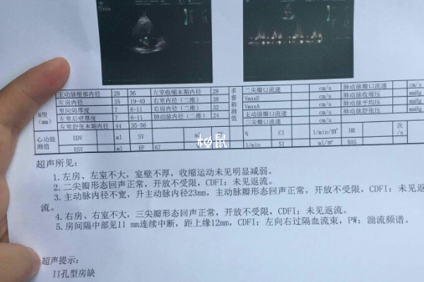 试管不会增加心脏病患病概率