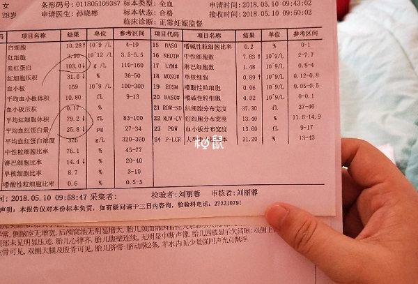 地中海贫血遗传概率不固定