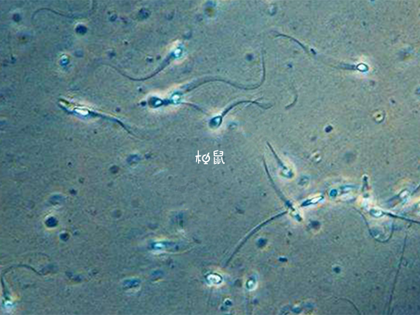 少精症与弱精症有区别
