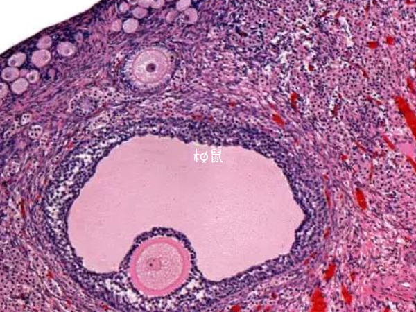 空卵泡壁非常薄