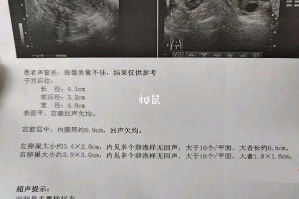 成熟卵泡排出会出现体温升高的症状