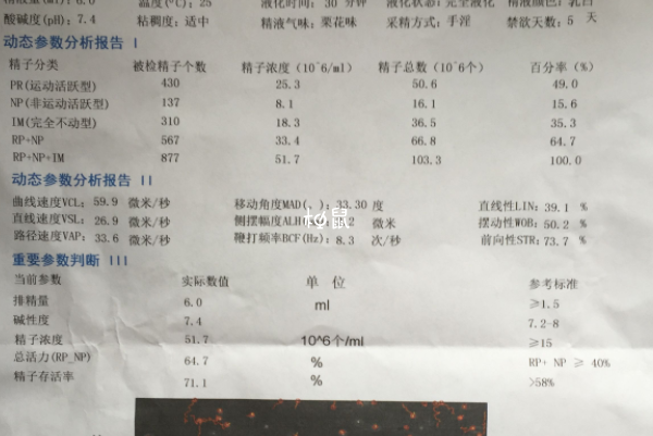 禁欲15天可以检查精液质量